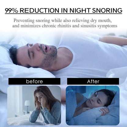 Anti-Snoring Breathing Patch